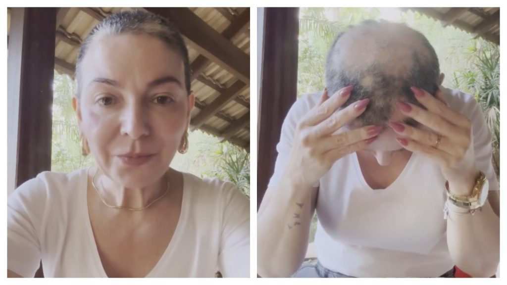 Mãe de Lucas Lucco revela volta de alopecia areata e desabafa nas redes: ‘Vou seguir firme’